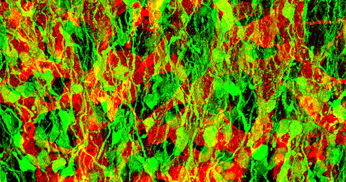Confocal image of GFP-positive neural progenitor cells