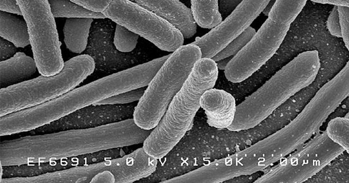Black and white microscopic image of bacteria