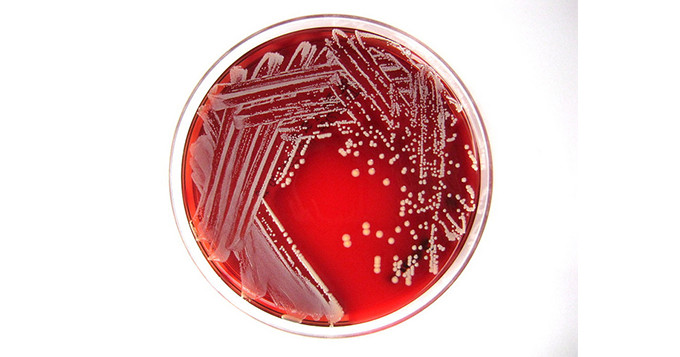 Bacteria on petri dish