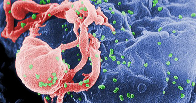 Scanning electron micrograph of HIV-1 budding (in green) from cultured lymphocyte