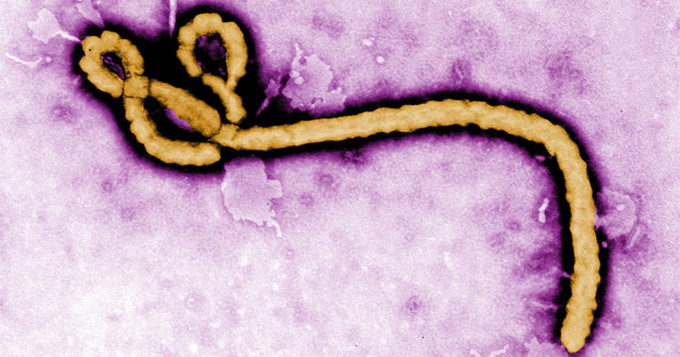 Image of microscopic Ebola virus. Image credit: CDC.