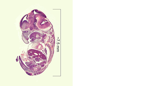 Mouse embryo