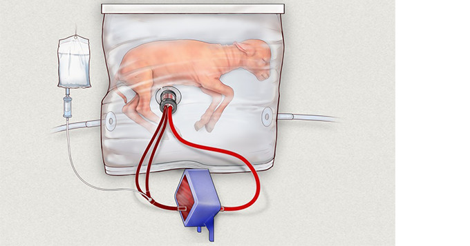Image credit: Artificial womb. Children’s Hospital of Philadelphia / Nature Communications