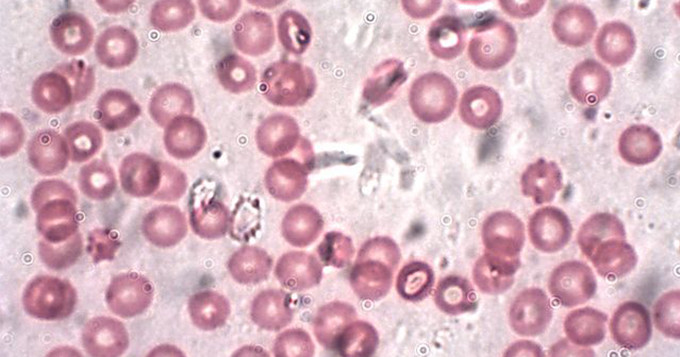 Human red blood cells. John Alan Elson, Wikimedia.