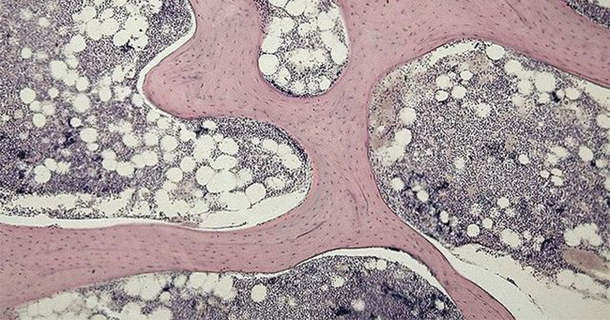 Microscopic image of cells of spongy bone